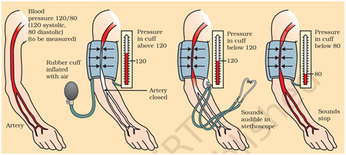 CLASS 10 BIOLOGY LIFE PROCESSES IMPORTANT QUESTION AND ANSWERS