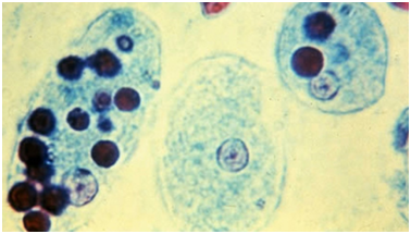 Class 8 Microorganisms Entamoeba