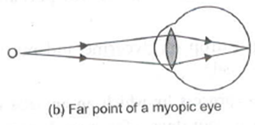 Human Eye and The Colourful World For Class 10 Physics Important Questions