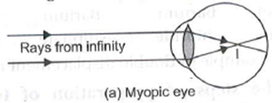 Human Eye And The Colourful World Class 10 Physics Important